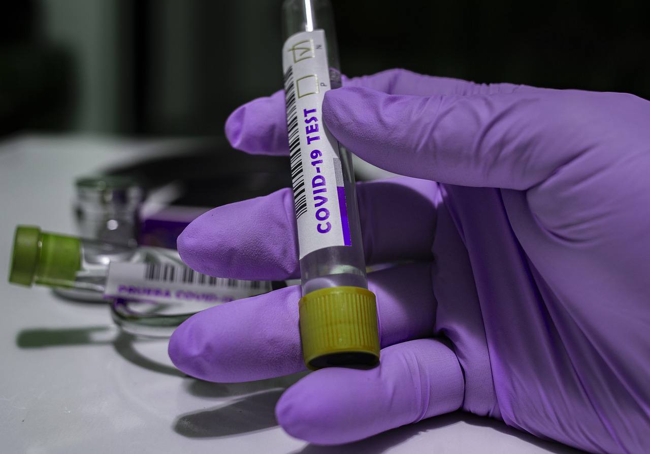 Врачи выявили за минувшие сутки 12 046 случаев заболевания коронавирусом
